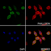 3 - Anti-A4GNT Antibody AP50943
