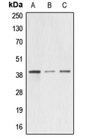 1 - Anti-A4GNT Antibody AP50943