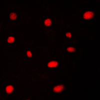 3 - Anti-AATF Antibody AP50944