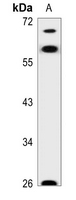 1 - Anti-AATF Antibody AP50944