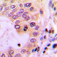 19 - Anti-ABCC13 Antibody AP50946