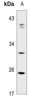 1 - Anti-ABCC13 Antibody AP50946