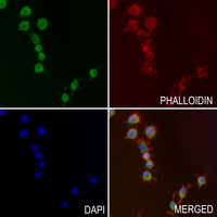 3 - Anti-ABCD4 Antibody AP50947