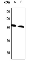 1 - Anti-ABCD4 Antibody AP50947