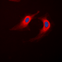 3 - Anti-ABHD12B Antibody AP50951