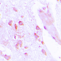 19 - Anti-ABHD12B Antibody AP50951