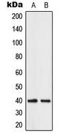 1 - Anti-ABHD12B Antibody AP50951