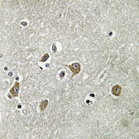 19 - Anti-ABHD8 Antibody AP50952