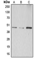 1 - Anti-ABHD8 Antibody AP50952