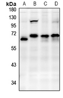 1 - Anti-ABI1 Antibody AP50953