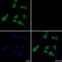 3 - Anti-ACAT1 Antibody [KO/KD Validated] AP50955