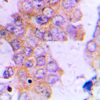 19 - Anti-ACAT1 Antibody [KO/KD Validated] AP50955