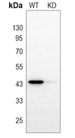 0 - Anti-ACAT1 Antibody [KO/KD Validated] AP50955