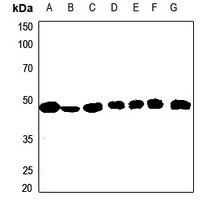 1 - Anti-ACAT1 Antibody [KO/KD Validated] AP50955