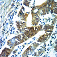 19 - Anti-Acetylcholinesterase Antibody AP50956