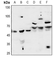1 - Anti-Acetylcholinesterase Antibody AP50956