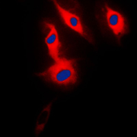 3 - Anti-ACRBP Antibody AP50957