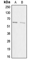 1 - Anti-ACRBP Antibody AP50957