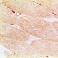 19 - Anti-Alpha-actin-1 Antibody AP50958