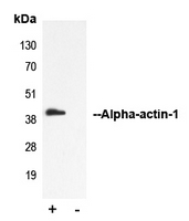 5 - Anti-Alpha-actin-1 Antibody AP50958