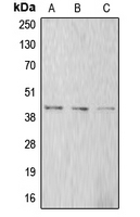 1 - Anti-Alpha-actin-1 Antibody AP50958
