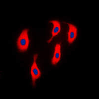 3 - Anti-ACTN2 Antibody AP50959