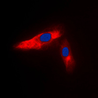 3 - Anti-ACTN3 Antibody AP50960