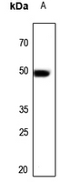1 - Anti-ARP3 Antibody AP50961