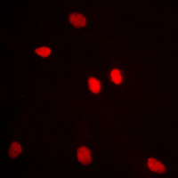 3 - Anti-ADAR2 Antibody AP50962