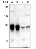 1 - Anti-ADAR2 Antibody AP50962