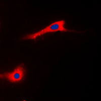 3 - Anti-CABC1 Antibody AP50963