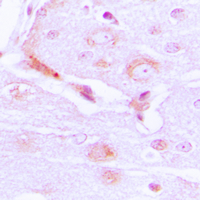 19 - Anti-CABC1 Antibody AP50963