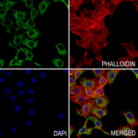 3 - Anti-Adenylate Cyclase 1 Antibody AP50964