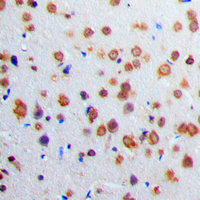 19 - Anti-Adenylate Cyclase 1 Antibody AP50964