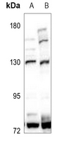 1 - Anti-Adenylate Cyclase 1 Antibody AP50964