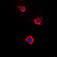 3 - Anti-Adenylate Cyclase 5/6 Antibody AP50965