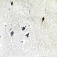 19 - Anti-Adenylate Cyclase 5/6 Antibody AP50965