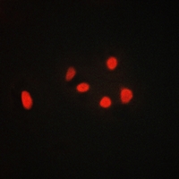 3 - Anti-Gamma-adducin Antibody AP50966