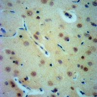 19 - Anti-Gamma-adducin Antibody AP50966