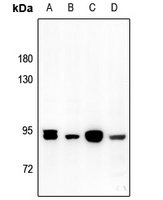 1 - Anti-Gamma-adducin Antibody AP50966