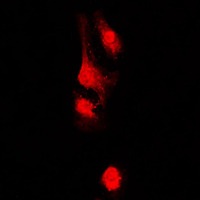 3 - Anti-AKAP13 Antibody AP50968