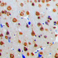 19 - Anti-AKAP13 Antibody AP50968
