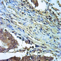 19 - Anti-ALDH2 Antibody AP50970