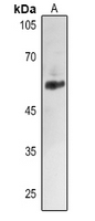 1 - Anti-ALDH2 Antibody AP50970