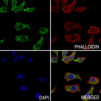 3 - Anti-ALDH3A1 Antibody AP50971