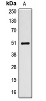 1 - Anti-ALDH3A1 Antibody AP50971
