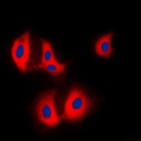 3 - Anti-ALDOA Antibody AP50972
