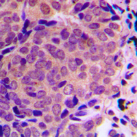 19 - Anti-ALMS1 Antibody AP50973