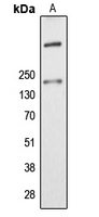 1 - Anti-ALMS1 Antibody AP50973