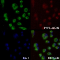 3 - Anti-ANGPTL1 Antibody AP50975